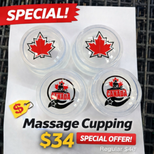 Massage Cupping Set (4-Pack) – Special Offer